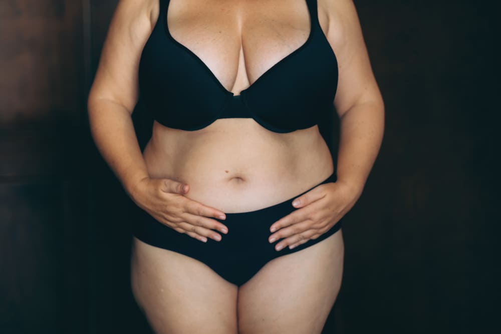 Full Tummy Tuck​