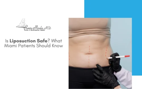 safe-what-miami-patients-should-know