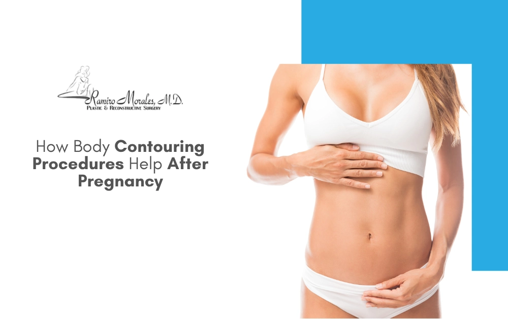 contouring-procedures-help-after-pregnancy