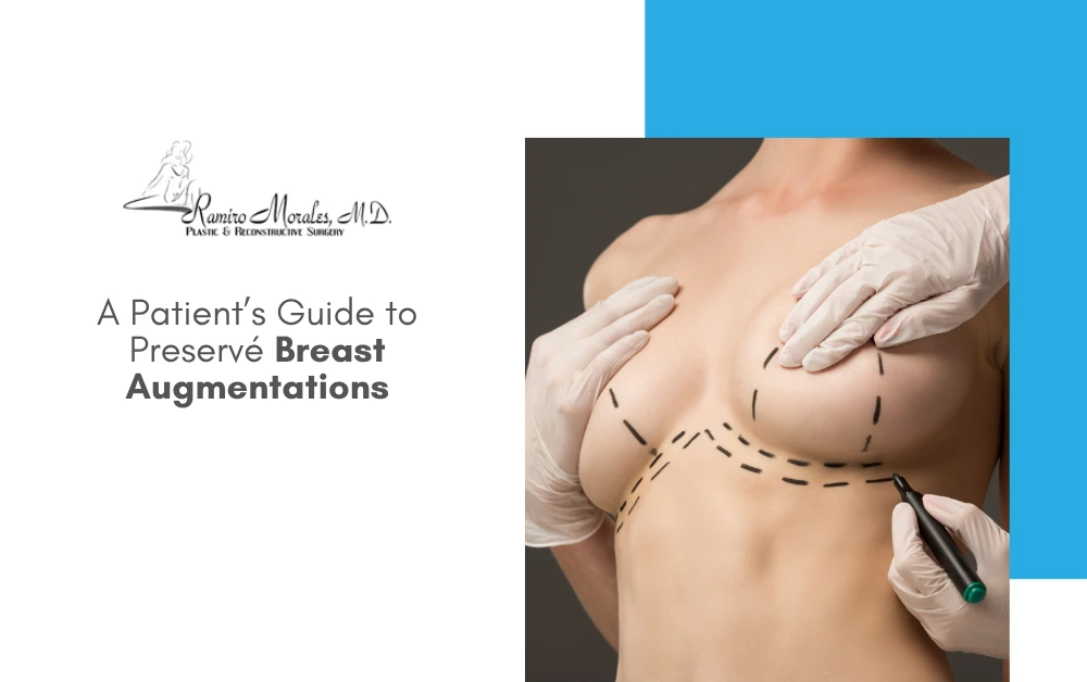 guide-to-preserve-breast-augmentations