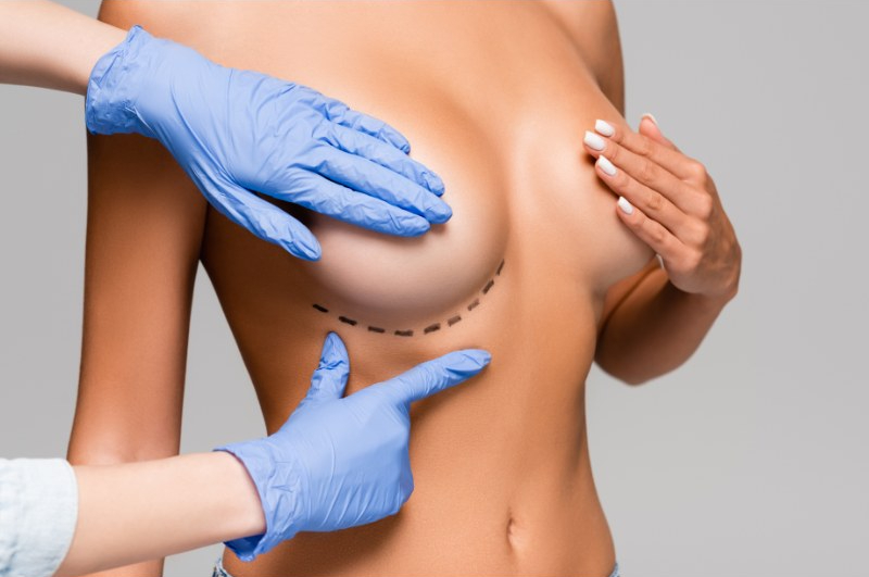 Should you opt for non surgical breast lift?