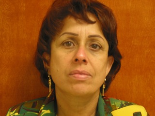 After photo of Facelift case 1 by Dr. Ramiro Morales, plastic surgeon in Miami, FL