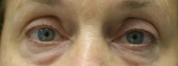 03-before-front-qbkt4qpxwxmwypoidensfdtt9dr05bnj0paj42z8no