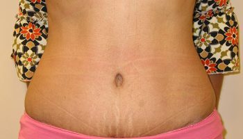 front-after3-qbks4pknxkbm8g5ot31ctg8prc9ez4zrvsuy9az0i8