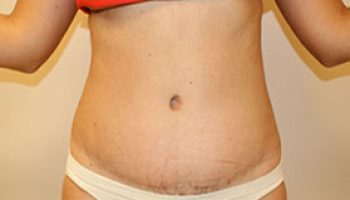 front-after41-qbks5q8dc3pst8ofv0vt0ozoxd8qbc1b0uavz3gnrk