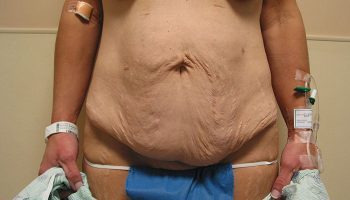 front-before-qbks30h5lbzz9smfpumltdnr5amk2t97zege2bhlqo