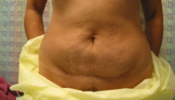 front-before1-qbks3nz4c6w5c1oawmsa1pq9zxeqf8uiemrj28irf4