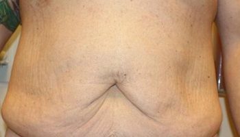 pre-1-qbks85nczp1gsz5goko3ykxk679v76occuz1ltv1ow