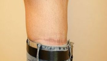 pre4-qbks89epr16m3f002mam8jzejqrc1z39pdkzixph00