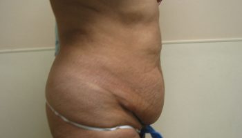 side-before-qbks4u9uvqi1uhyv1n2hnx20q9m91mifkg4dnos1n4